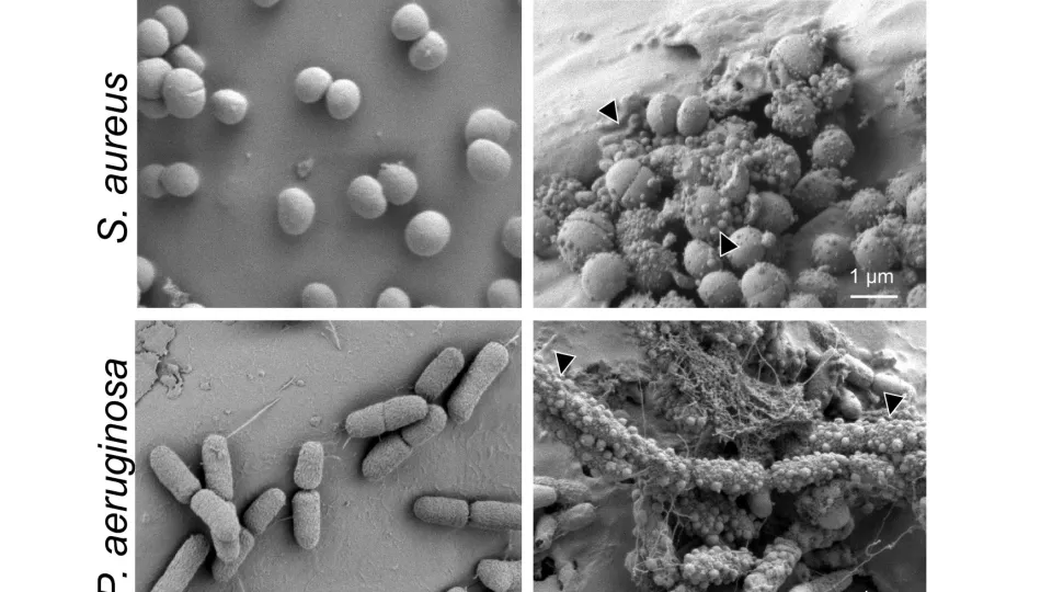 bacteria. photo.