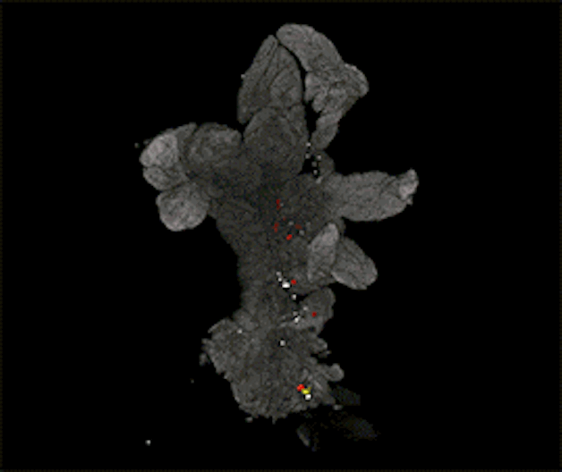 Medical image from the OPT imaging platform showing organic tissue.