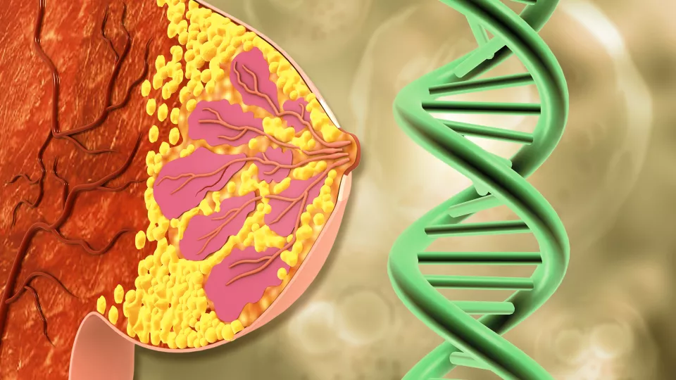 illustration of breastcancer and genes. photo.