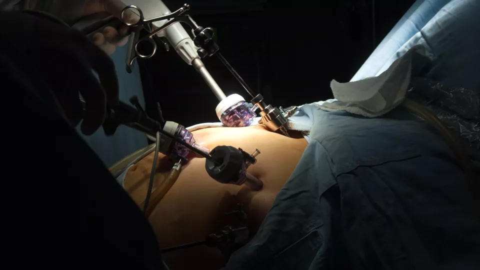 patient undergoing gastric bypass surgery. photo.