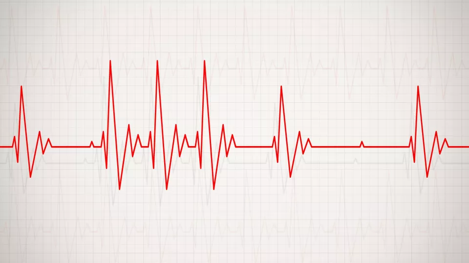 ECGs record. photo.