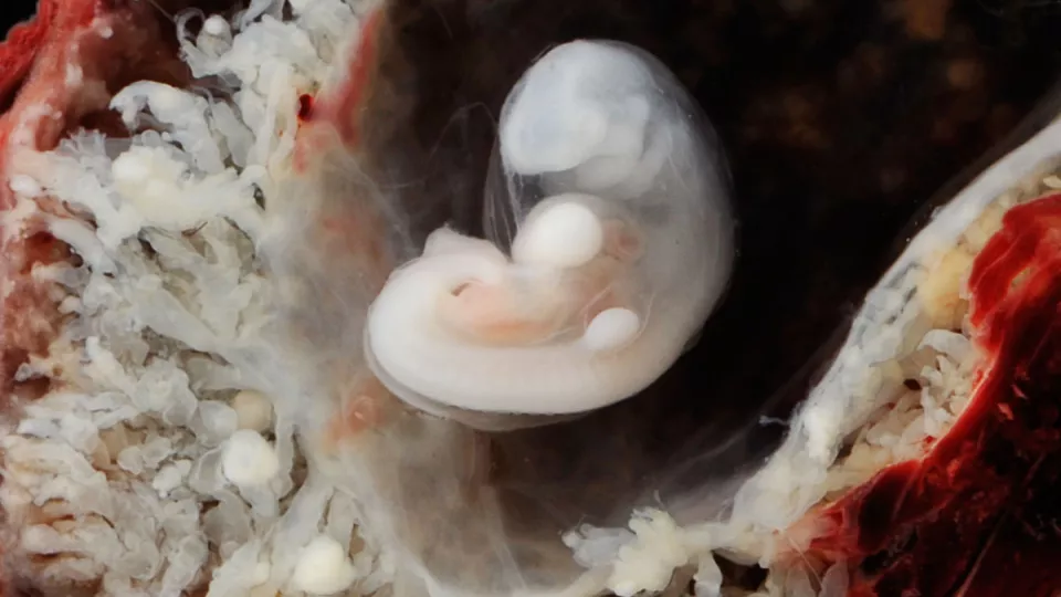 Image of a human embryo surrounded by placenta, around 7 weeks of age.