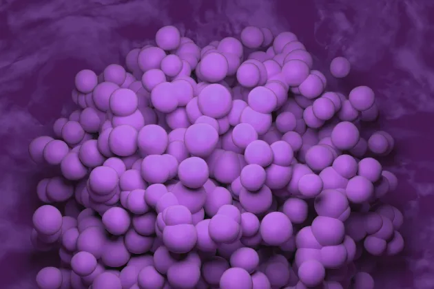 An image of a glioblastoma tumour. Photo: iStock