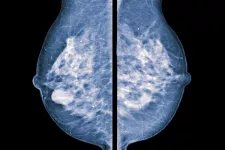 picture of breast tumor. photo.