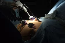 patient undergoing gastric bypass surgery. photo.
