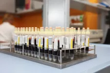 picture of blood samples. photo.