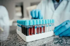 Blood samples in a container, photography. Photo: iStock