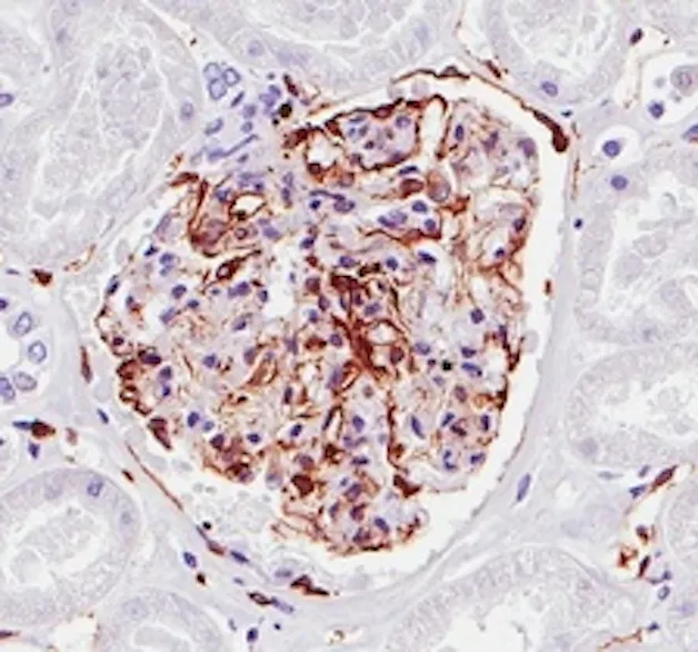 Kidney tissue stained with vimentin antibody. 