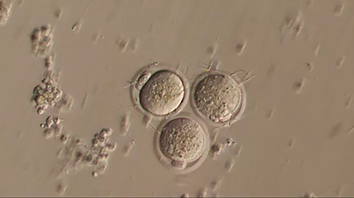 In-vitro fertilization of mouse oocyte. Microscopy photo.