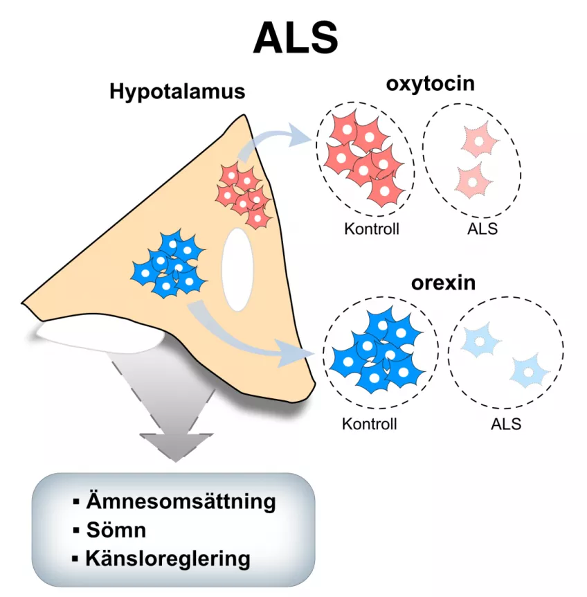 Illustration of ALS