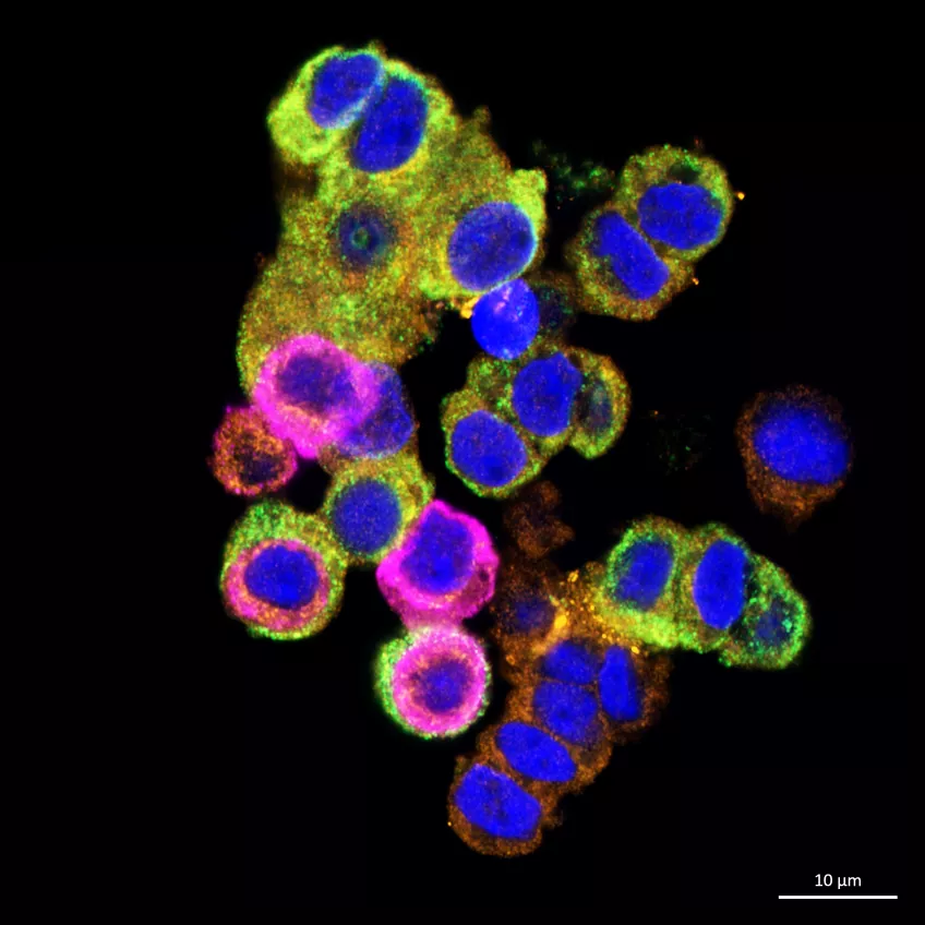 Microscopy image of isolated islets of Langerhans, where the beta cells that produce insulin are located. The orange in the picture is the protein variant IRIS-2, the green insulin and the blue are cell nuclei. Photo.